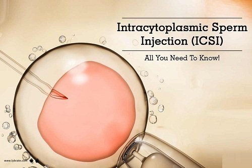 INTRA CYTOPLASMIC SPERM INJECTION  Ansh IVF Moga